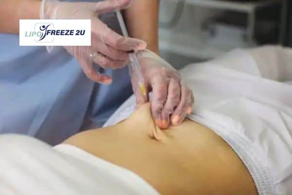 How Does Aqualyx Fat Dissolving Injection Work to Break Down Fat Felixstowe?