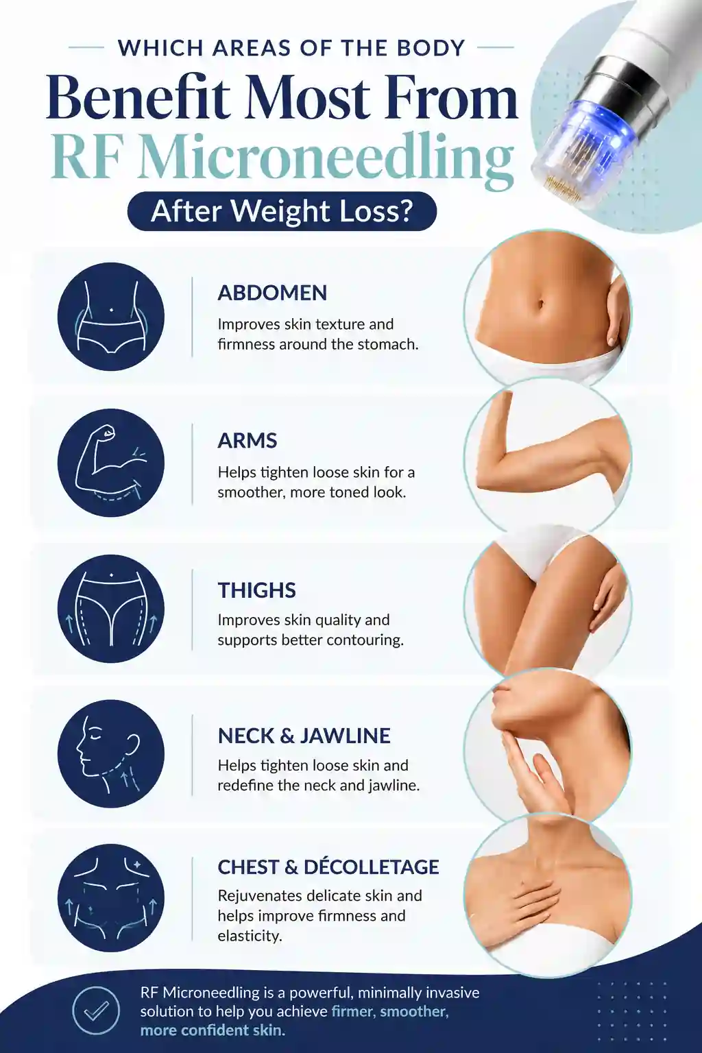 Which Areas of the Body Benefit Most From RF Microneedling After Weight Loss Felixstowe